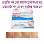Aichun Beauty Anti-Stretch Marks Cream | Stretch Marks Removal Cream 60g