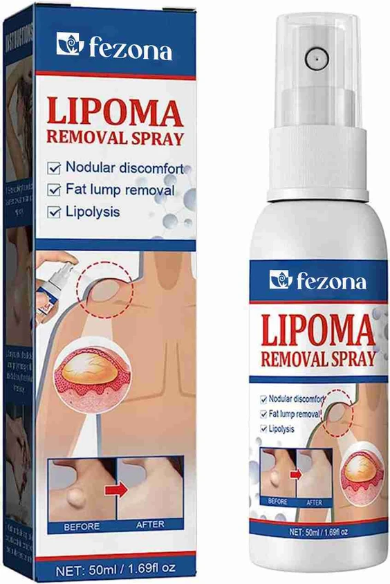 50-lipoma-remover-spray-50-gm-fezona-original-imagrr6j5s3uaagx